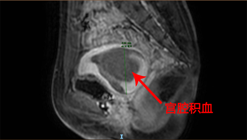 1F45D